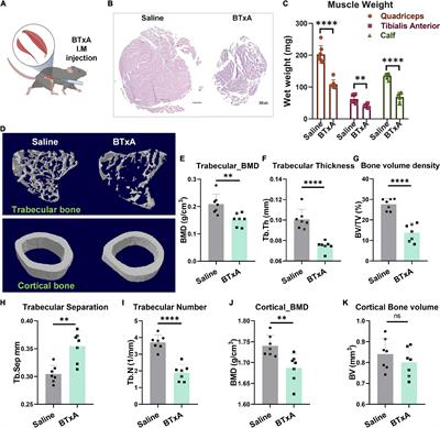 Basolateral Amygdala Mediates Central Mechanosensory Feedback of Musculoskeletal System